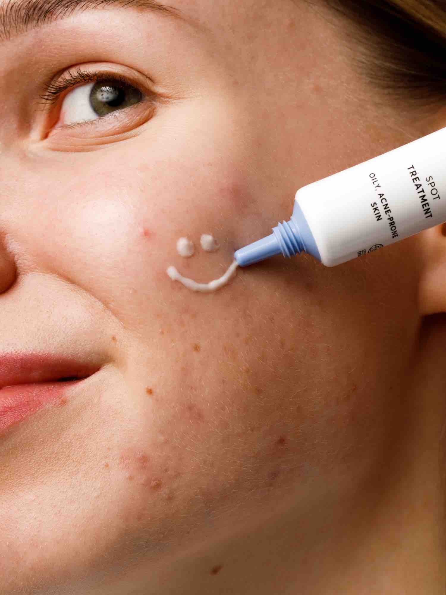 Acne Act Spot Treatment - IOrganic