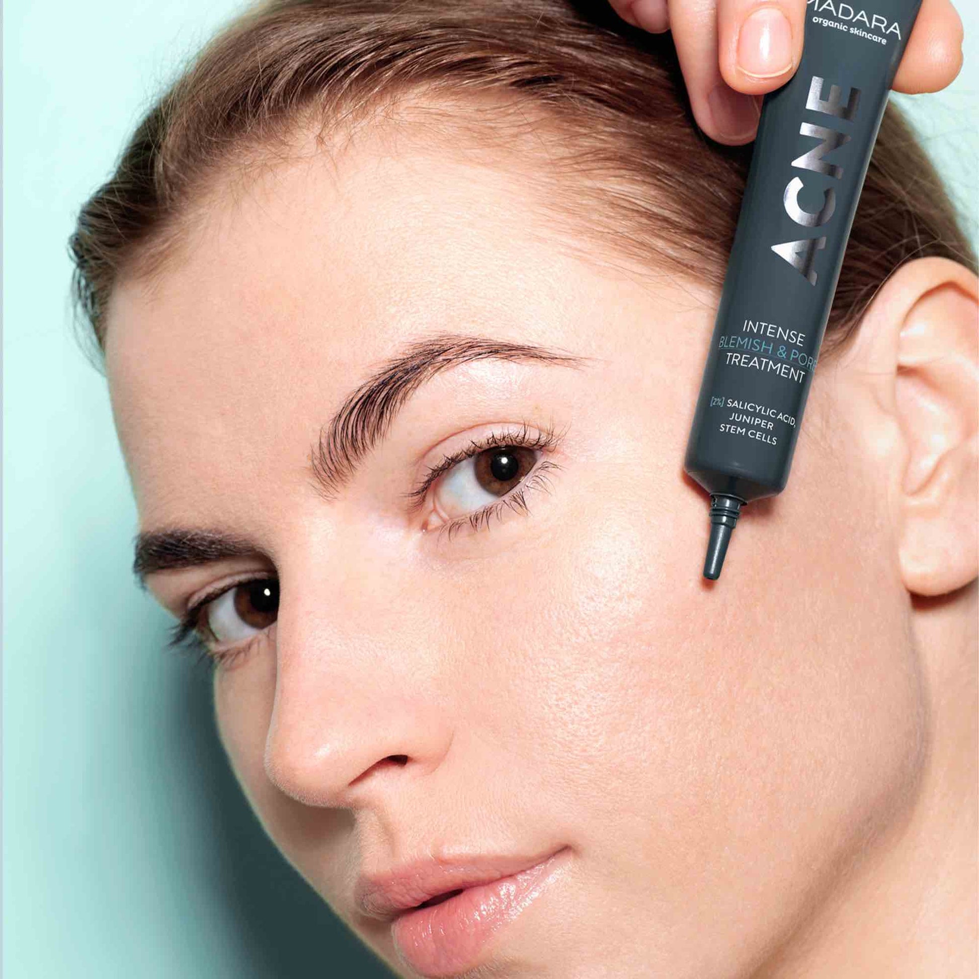 Acne Intense Blemish & Pore Treatment - IOrganic