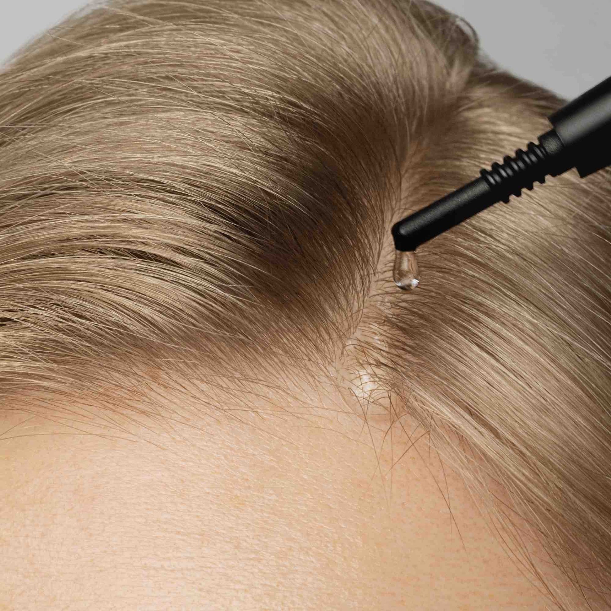 Scalp Peel Serum - IOrganic